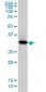 QPRT Antibody (monoclonal) (M01)